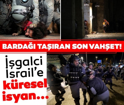 İsrail'in bardağı taşıran son vahşeti: Yüze ve göze mermi! Zulme küresel isyan... 