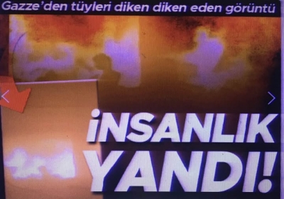 Katil İsrail çocukları diri diri yaktı: Gazze’den gelen görüntüler içler acısı
