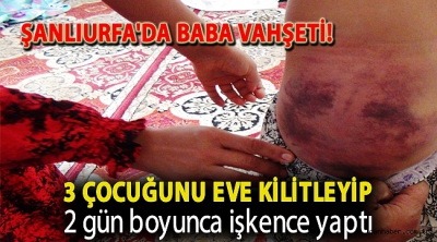 Şanlıurfa’da vicdansız baba vahşeti!.