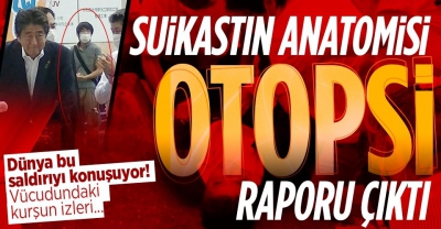 Son dakika: Adım adım Shinzo Abe suikatı! Hayrete düşüren zaaflar 