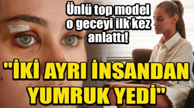 Ukraynalı model Daria Kyryliuk darp iddiasıyla ilgili konuştu.